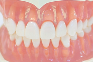 総義歯治療